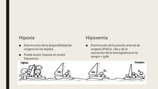 Hipoxia
■ Disminución de la disponibilidad de
oxígeno en los tejidos.
■ Puede existir hipoxia sin existir
hipoxemia
Hipoxemia
■ Disminución de la presión arterial de
oxigeno (PaO2) <60 y de la
saturación de la hemoglobina en la
sangre < 93%
 