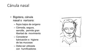 • Bigotera, cánula
nasal o naricera:
– flujos bajos de oxígeno
– Cómoda, segura,
sencilla, permite gran
libertad de movimiento
– Considerar
lubricación e higiene
de las mucosas
– Debe ser utilizada
con humificadores
Cánula nasal
 
