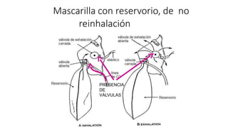 Mascarilla con reservorio, de no
reinhalación
PRESENCIA
DE
VÁLVULAS
 