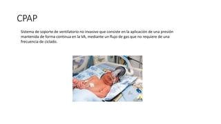 CPAP
Sistema de soporte de ventilatorio no invasivo que consiste en la aplicación de una presión
mantenida de forma continua en la VA, mediante un flujo de gas que no requiere de una
frecuencia de ciclado.
 