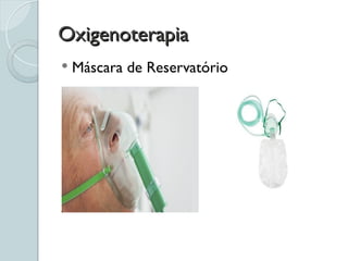 Oxigenoterapia
Oxigenoterapia
 Máscara de Reservatório
 