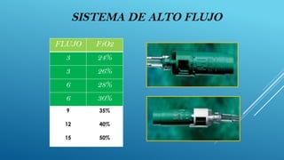 Fio2 Flujo OXIGENOTERAPIAAAAAAAAAAAAAAAAAAAAAAAAAAAAAAAAAAAA | PPTX