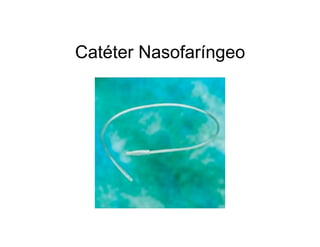 Catéter Nasofaríngeo
 