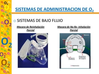 O2
     O2O2
O2
O2 O O2       SISTEMAS DE ADMINISTRACION DE O2
 O2 2 O2
O2 O2
O2 O2 O2
              o SISTEMAS DE BAJO FLUJO
O2
O2 O2
     O2        Macara de Reinhalación   Macara de No Re- Inhalación
O   O2
  2 O2                Parcial                     Parcial
O2 O
  O2 2
O2 O

O2
O2 O
O2    2
          2




     O2 O2
O2
O2
     O2 O2
        O
      O2 2

O2
O2 O2
        O2

O2O2 O
      2
O2O2 O2
 