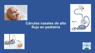 Cánulas nasales de alto
flujo en pediatría
 