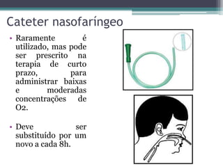 Cateter nasofaríngeo
• Raramente é
utilizado, mas pode
ser prescrito na
terapia de curto
prazo, para
administrar baixas
e moderadas
concentrações de
O2.
• Deve ser
substituído por um
novo a cada 8h.
 