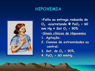 HIPOXEMIA
Falta ou entrega reduzida de
O2, acarretando  PaO2 < 60
mm Hg ≈ Sat O2 < 90% .
Sinais clínicos de Hipoxemia
1. Agitação;
2. Cianose de extremidades ou
central;
3. Sat. de O2 < 90%.
4. PaO2 < 60 mmHg.
 