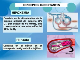CONCEPTOS IMPORTANTES
Consiste en la disminución de la
presión arterial de oxigeno (Pa
O2) por debajo de 60 mmHg, que
corresponde a una saturación del
90% de O2.
Consiste en el déficit en el
transporte de O2 hacia los tejidos.
HIPOXEMIA
HIPOXIA
 