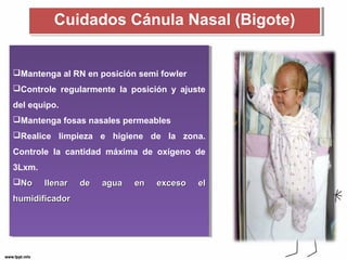 Cuidados CCáánnuullaa NNaassaall ((BBiiggoottee)) 
Mantenga al RN en posición semi fowler 
Controle regularmente la posición y ajuste 
del equipo. 
Mantenga fosas nasales permeables 
Realice limpieza e higiene de la zona. 
Controle la cantidad máxima de oxígeno de 
3Lxm. 
NNoo lllleennaarr ddee aagguuaa eenn eexxcceessoo eell 
hhuummiiddiiffiiccaaddoorr 
Mantenga al RN en posición semi fowler 
Controle regularmente la posición y ajuste 
del equipo. 
Mantenga fosas nasales permeables 
Realice limpieza e higiene de la zona. 
Controle la cantidad máxima de oxígeno de 
3Lxm. 
NNoo lllleennaarr ddee aagguuaa eenn eexxcceessoo eell 
hhuummiiddiiffiiccaaddoorr 
 