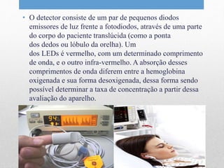 • O detector consiste de um par de pequenos diodos 
emissores de luz frente a fotodiodos, através de uma parte 
do corpo do paciente translúcida (como a ponta 
dos dedos ou lóbulo da orelha). Um 
dos LEDs é vermelho, com um determinado comprimento 
de onda, e o outro infra-vermelho. A absorção desses 
comprimentos de onda diferem entre a hemoglobina 
oxigenada e sua forma desoxigenada, dessa forma sendo 
possível determinar a taxa de concentração a partir dessa 
avaliação do aparelho. 
 