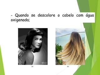 QUÍMICA, 3ª ANO
Oxirredução (Regras do Nox)
- Quando se descolore o cabelo com água
oxigenada;
(a) (b)
 