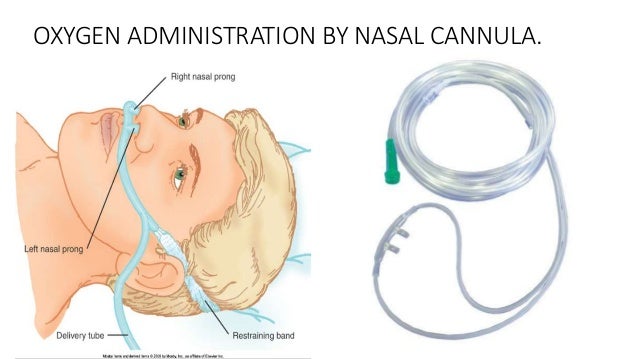 how to put oxygen cannula in nose