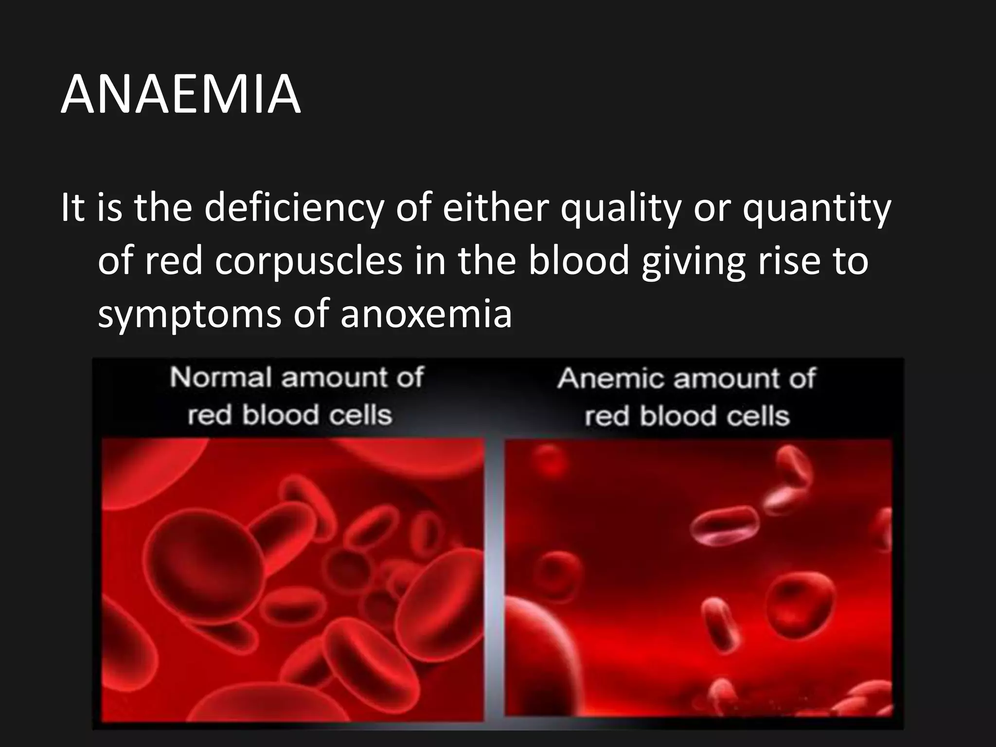 ANAEMIA
It is the deficiency of either quality or quantity
of red corpuscles in the blood giving rise to
symptoms of anoxemia
 