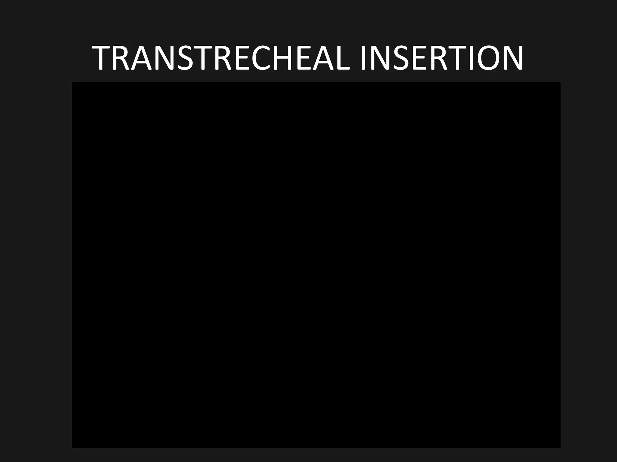 TRANSTRECHEAL INSERTION
 