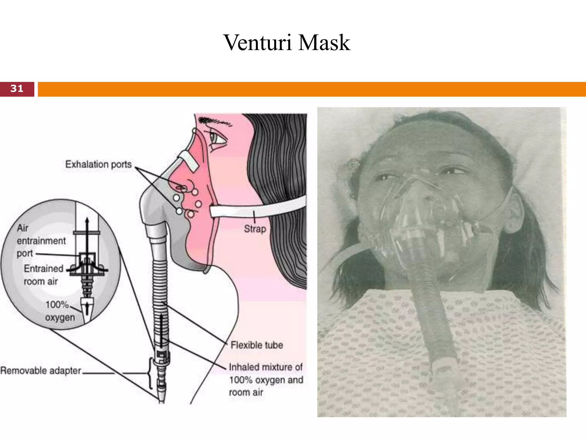 Venturi Mask
31
 