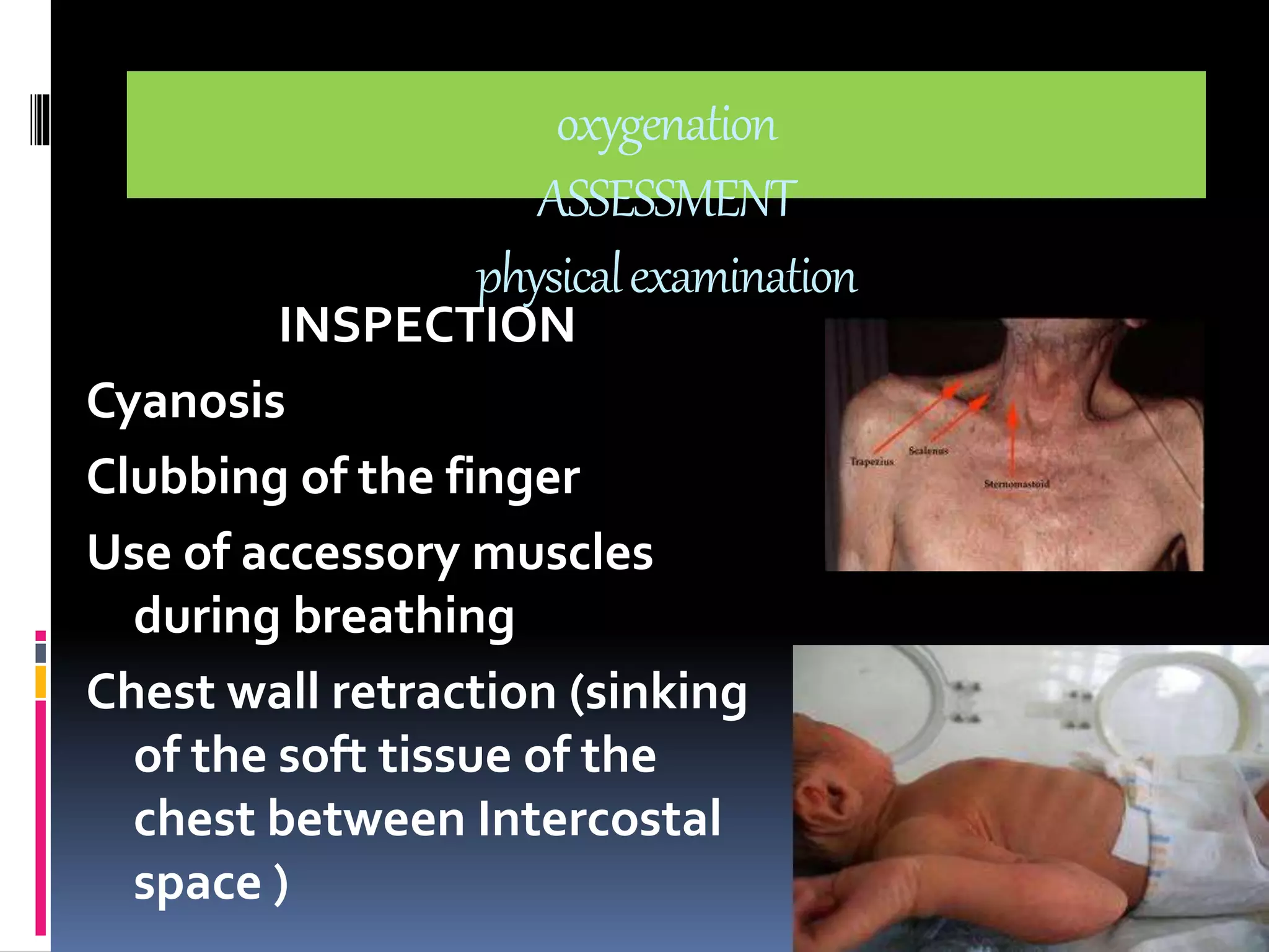 oxygenation 
ASSESSMENT 
physical examination 
INSPECTION 
Cyanosis 
Clubbing of the finger 
Use of accessory muscles 
during breathing 
Chest wall retraction (sinking 
of the soft tissue of the 
chest between Intercostal 
space ) 
 