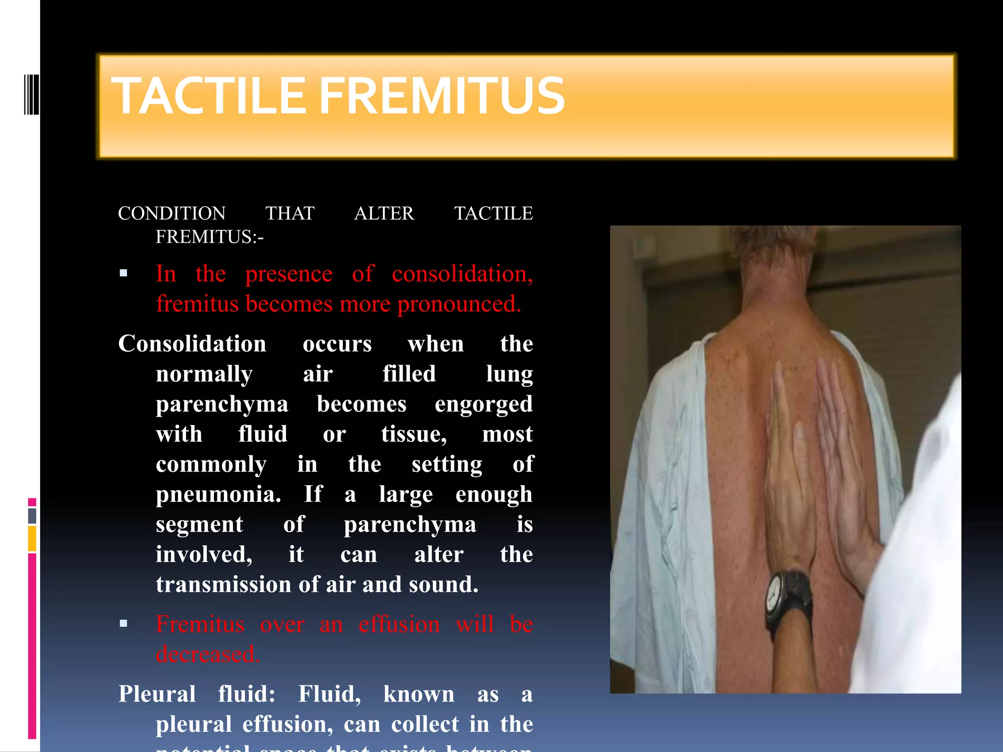 TACTILE FREMITUS 
CONDITION THAT ALTER TACTILE 
FREMITUS:- 
 In the presence of consolidation, 
fremitus becomes more pronounced. 
Consolidation occurs when the 
normally air filled lung 
parenchyma becomes engorged 
with fluid or tissue, most 
commonly in the setting of 
pneumonia. If a large enough 
segment of parenchyma is 
involved, it can alter the 
transmission of air and sound. 
 Fremitus over an effusion will be 
decreased. 
Pleural fluid: Fluid, known as a 
pleural effusion, can collect in the 
potential space that exists between 
 