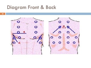 Diagram Front & Back 