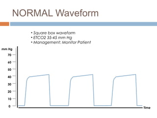 Boxy Spo2 Waveform Oxygenation and ventilation monitoring | PPT