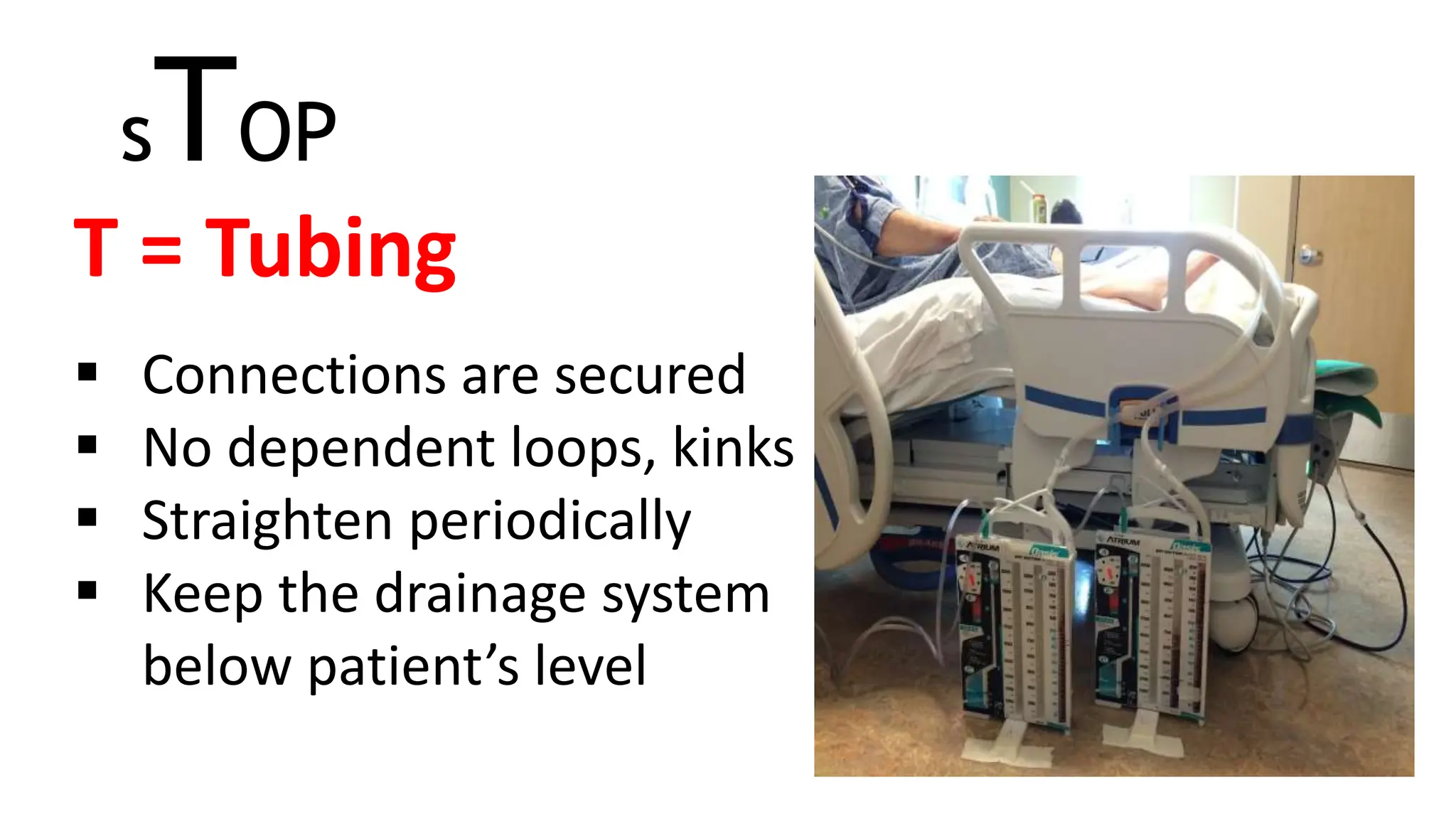 sTOP
T = Tubing
 Connections are secured
 No dependent loops, kinks
 Straighten periodically
 Keep the drainage system
below patient’s level
 