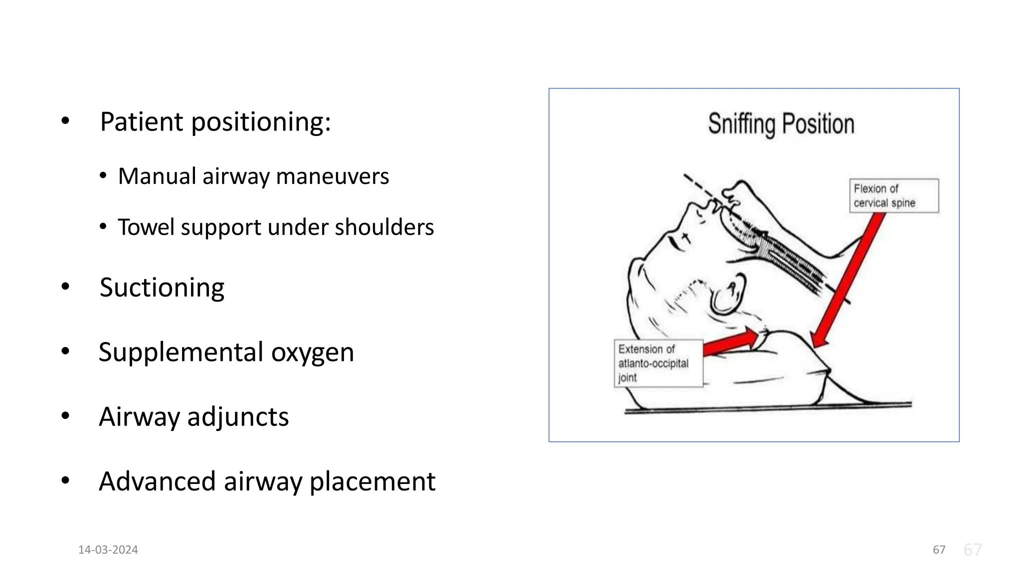 • Patient positioning:
• Manual airway maneuvers
• Towel support under shoulders
• Suctioning
• Supplemental oxygen
• Airway adjuncts
• Advanced airway placement
67
14-03-2024 67
 