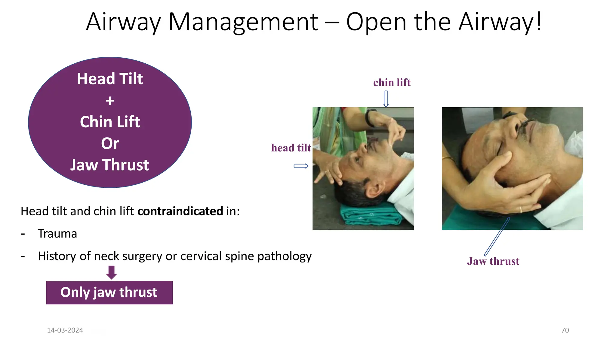 Jaw thrust
head tilt
chin lift
Head Tilt
+
Chin Lift
Or
Jaw Thrust
Head tilt and chin lift contraindicated in:
- Trauma
- History of neck surgery or cervical spine pathology
Only jaw thrust
Airway Management – Open the Airway!
14-03-2024 70
 