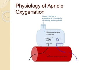 Physiology of Apneic
Oxygenation
 