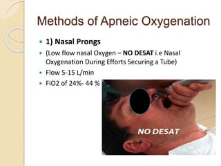 Methods of Apneic Oxygenation
 1) Nasal Prongs
 (Low flow nasal Oxygen – NO DESAT i.e Nasal
Oxygenation During Efforts Securing a Tube)
 Flow 5-15 L/min
 FiO2 of 24%- 44 %
 
