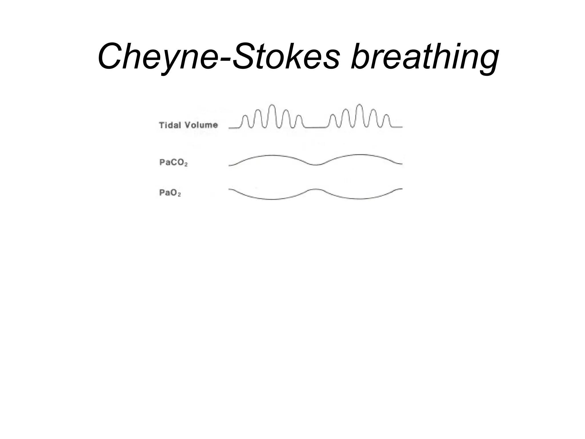 Cheyne-Stokes breathing
 