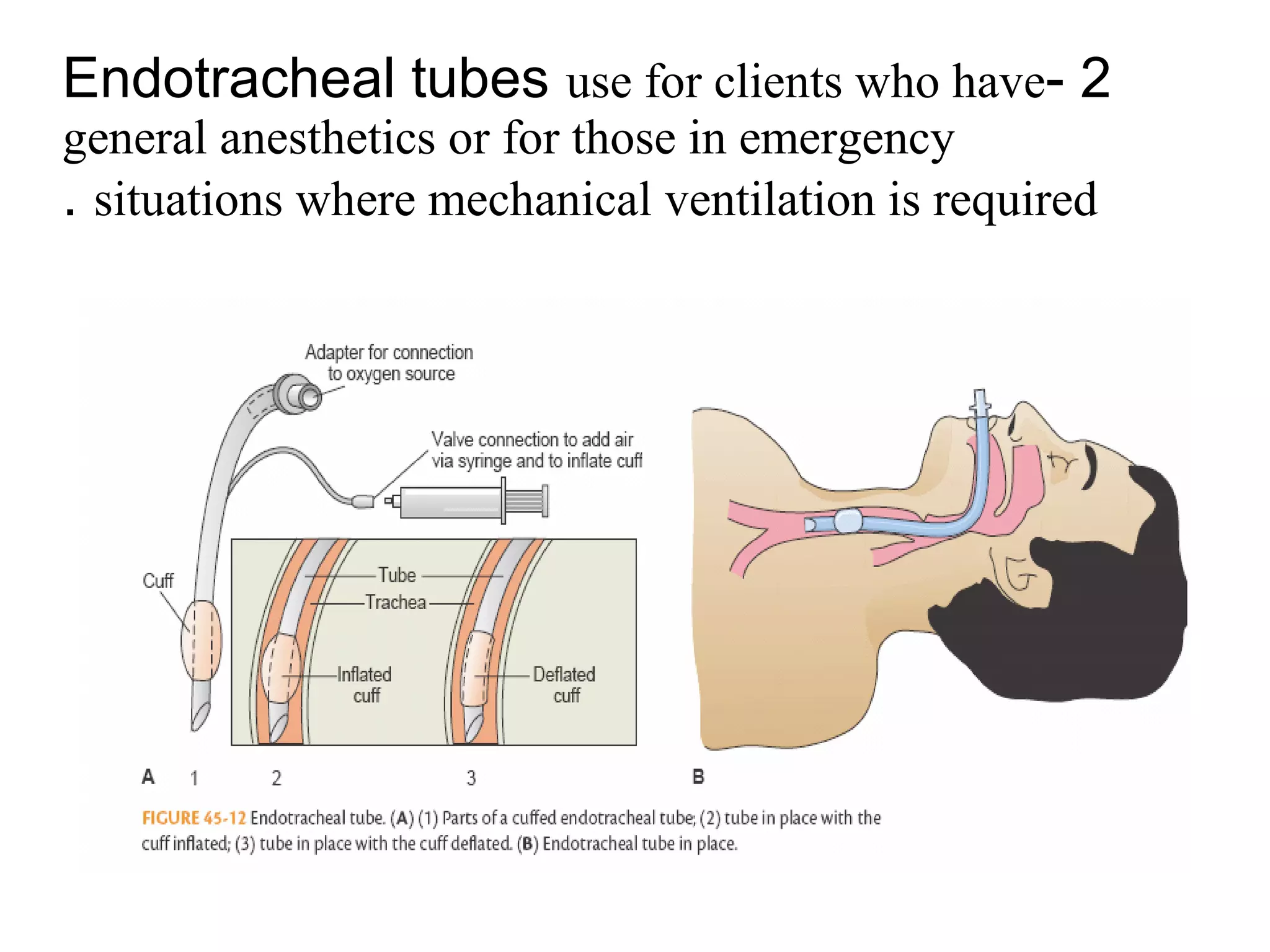 2
-
Endotracheal tubes use for clients who have
general anesthetics or for those in emergency
situations where mechanical ventilation is required
.
 