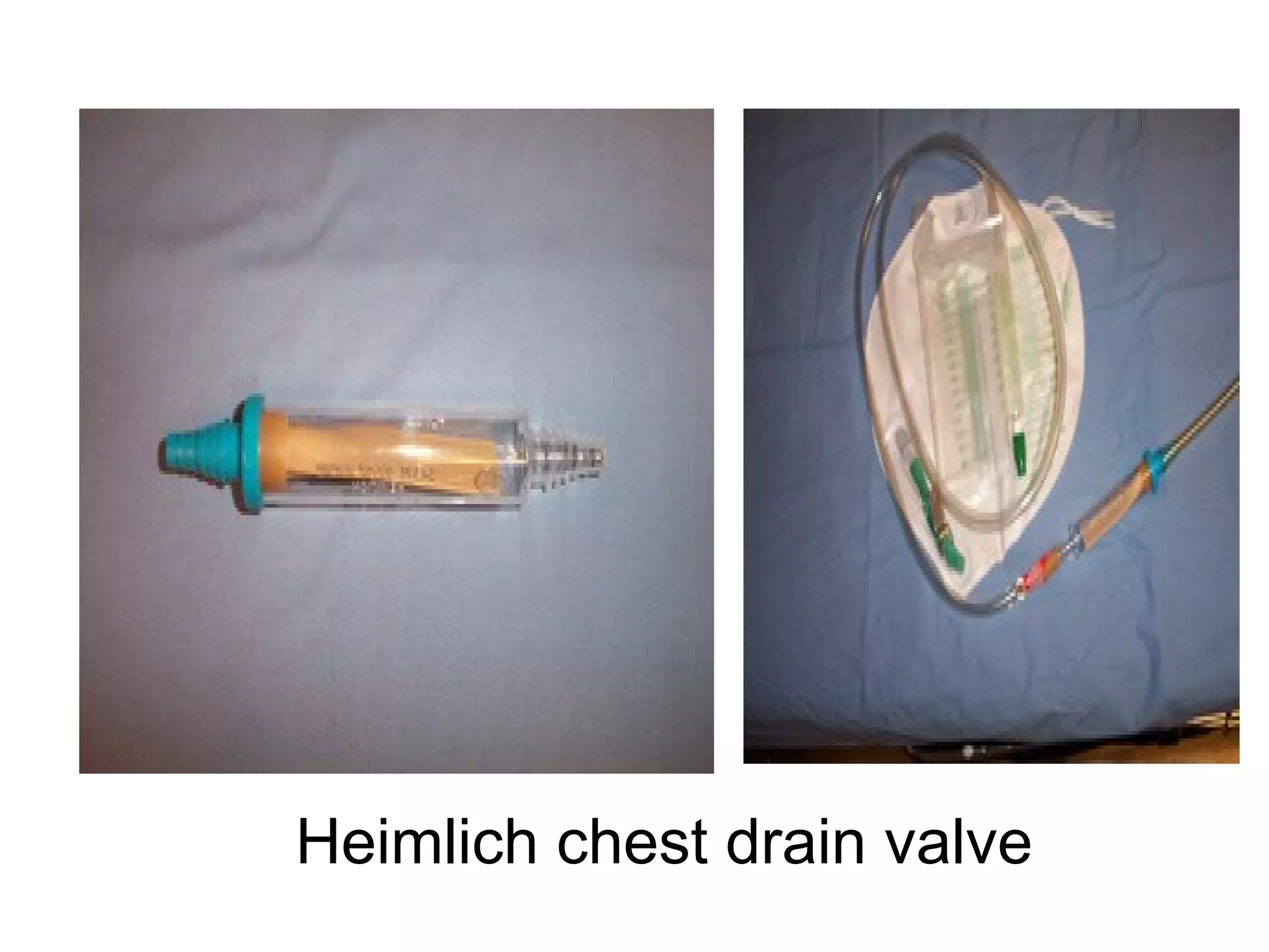 Heimlich chest drain valve
 