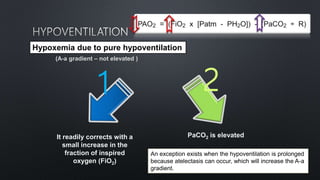 Hypoxemia due to pure hypoventilation
(A-a gradient – not elevated )
1
It readily corrects with a
small increase in the
fraction of inspired
oxygen (FiO2)
2
PaCO2 is elevated
An exception exists when the hypoventilation is prolonged
because atelectasis can occur, which will increase the A-a
gradient.
 