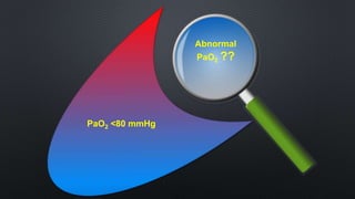 Abnormal
PaO2 ??
PaO2 <80 mmHg
 
