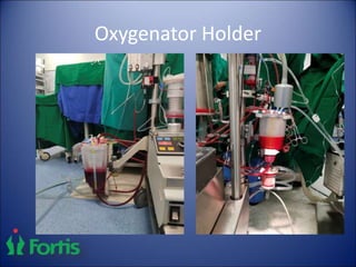 Oxygenator Holder
 