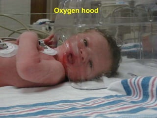 Oxygen hood
 