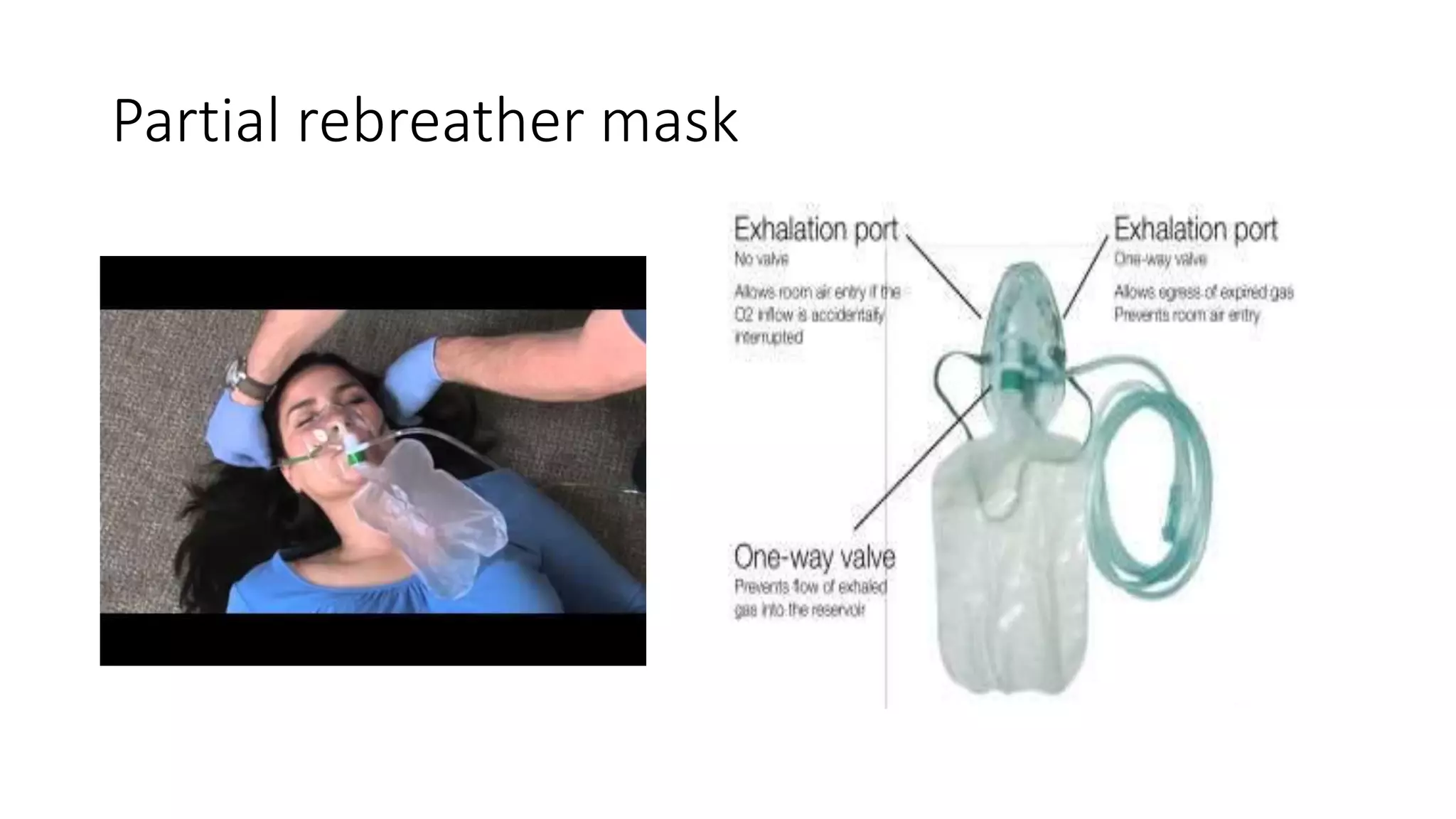 Partial rebreather mask
 