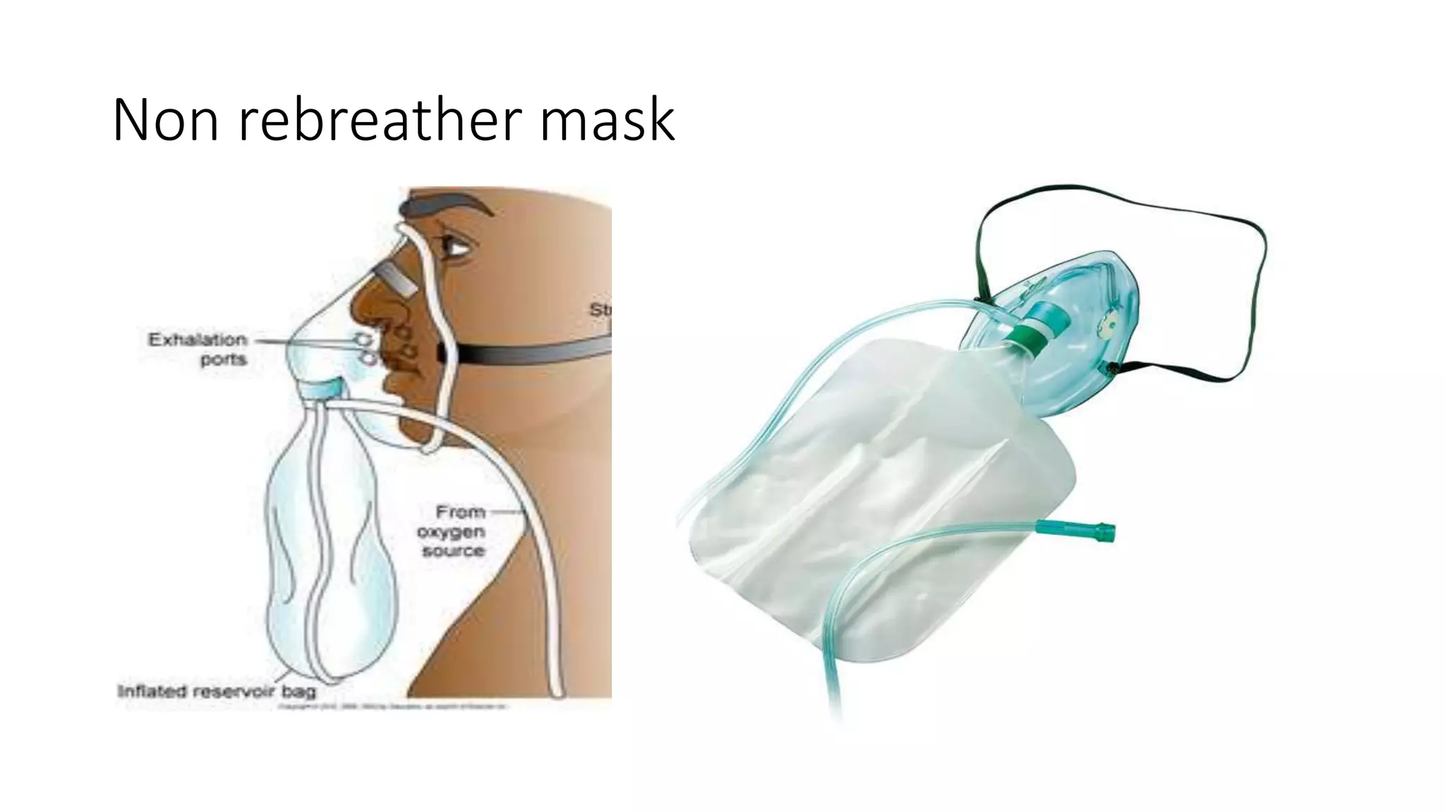 Non rebreather mask
 