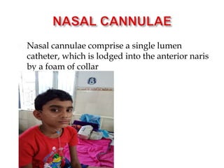  Nasal cannulae comprise a single lumen
catheter, which is lodged into the anterior naris
by a foam of collar
 