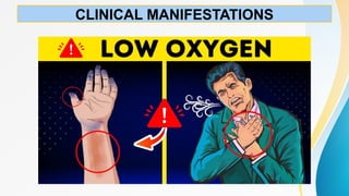 Hypoxemia Rash OXYGEN INSUFFICENCY,Hypoxemia is low levels of oxygen in your blood. It ...