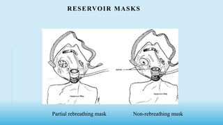 RESERVOIR MASKS
Partial rebreathing mask Non-rebreathing mask
 