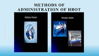 METHODS OF
ADMINISTRATION OF HBOT
 