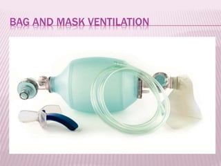 BAG AND MASK VENTILATION
 