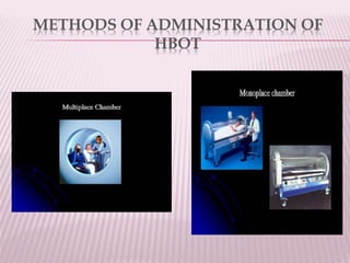 METHODS OF ADMINISTRATION OF
HBOT
 