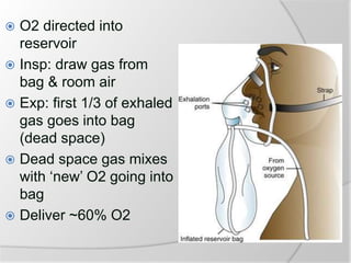  O2 directed into
reservoir
 Insp: draw gas from
bag & room air
 Exp: first 1/3 of exhaled
gas goes into bag
(dead space)
 Dead space gas mixes
with ‘new’ O2 going into
bag
 Deliver ~60% O2
 