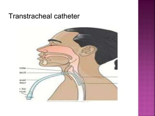 Transtracheal catheter
 