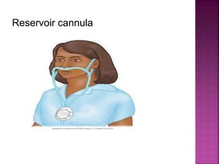 Reservoir cannula
 