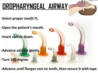 OROPHARYNGEAL AIRWAY
-Select proper size(0-7).
-Open the patient’s mouth.
-Insert upside down.
-Advance adjunct gently.
-Turn 180 degree.
-Advance until flanges rest on teeth, then secure it with tape
 