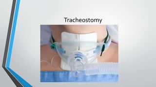 Tracheostomy
 