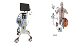 ECMO
 