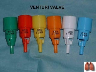VENTURI VALVE
 